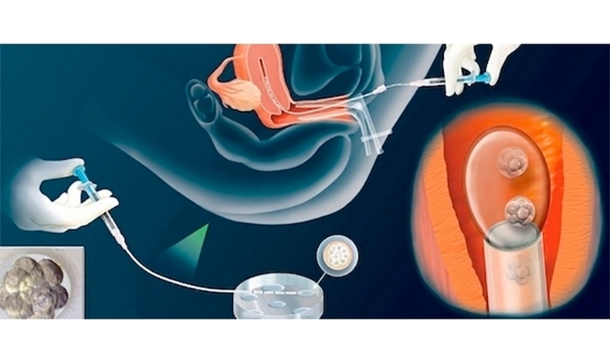 Embryotransfer